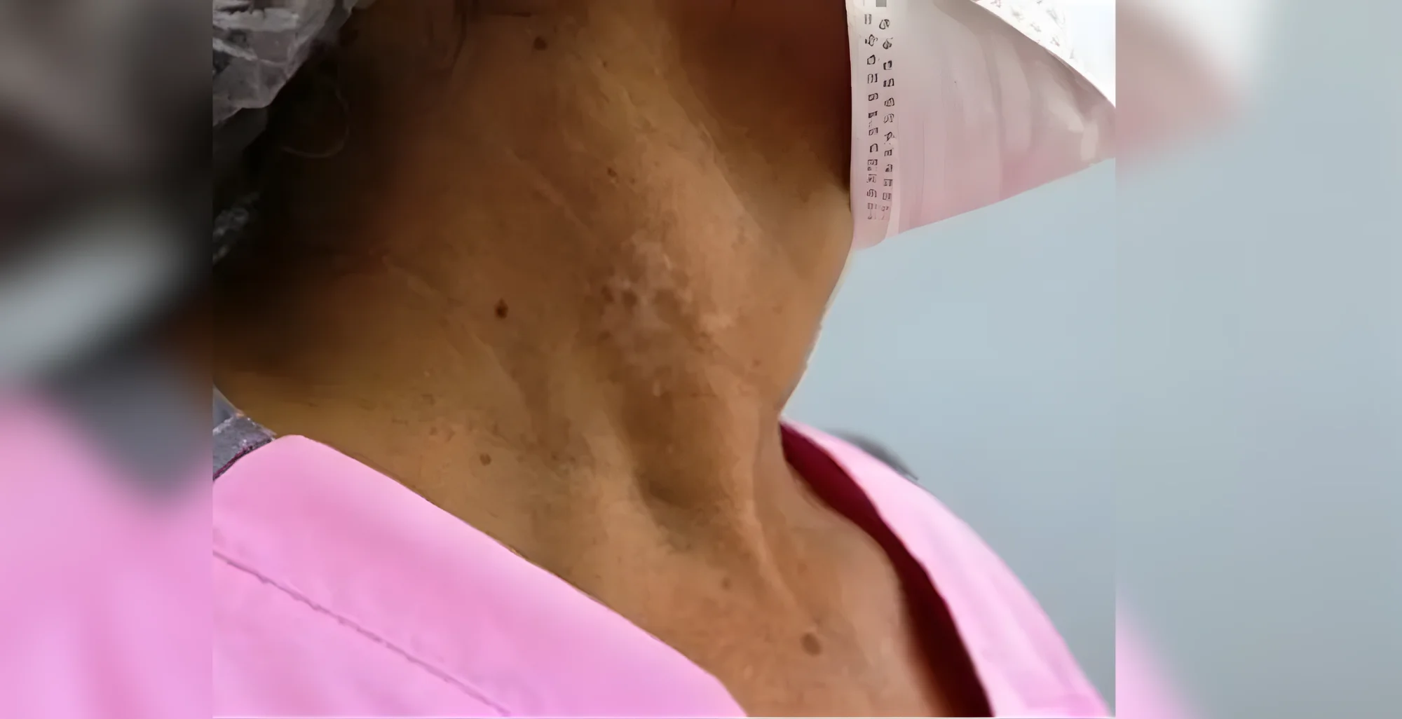 Dr. MD. Sabir Pasha - Breast & Thyroid Surgery Specialist